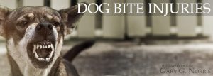 dog bites and related injuries - recommended lawyers