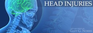 Head Injuries recommended lawyers