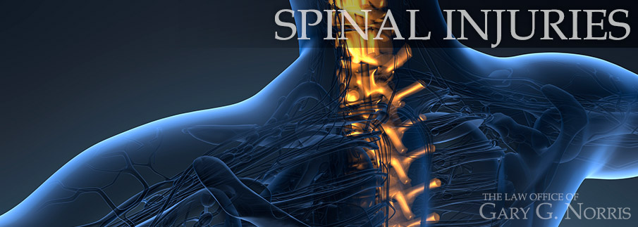 Spinal Injuries recommended lawyers